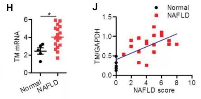 D1. (g)wcNAFLD߸KTMEM16A mRNAˮƽ(H)ԇTMEM16Aױ_(d)cNAFLDu֮gP(gun)ϵPearsonP(gun)Է(J)